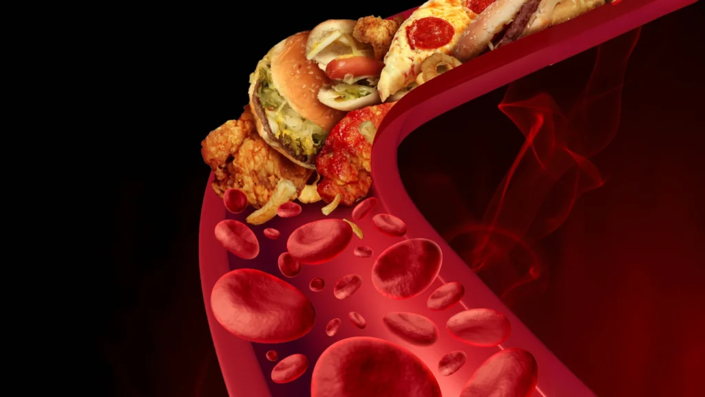 Dislipidemias Diagnóstico e Tratamentos.