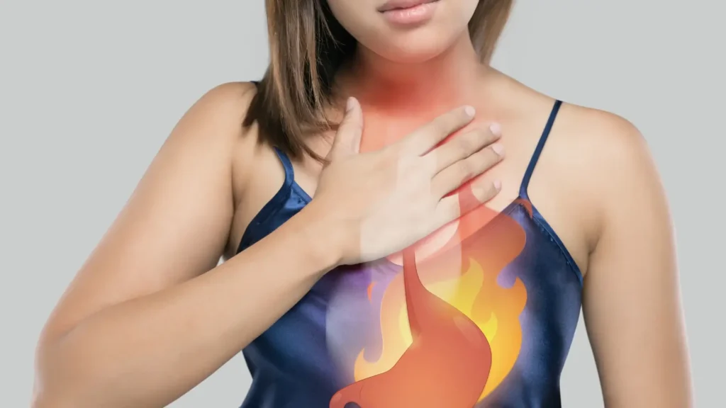 Estratégias simples para melhorar os sintomas do refluxo e azia