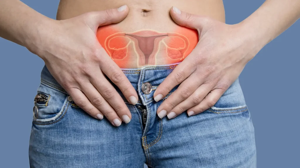 Descubra Tudo Sobre a Endometriose